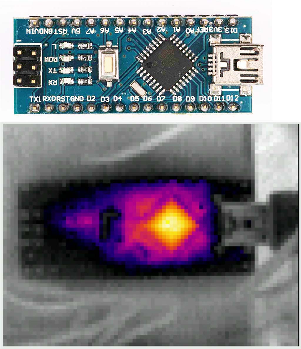 Thermal Image Arduino Nano